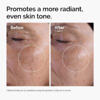 The Ordinary Glycolic Acid 7% Exfoliating Toner, Brightening and Smoothing Daily Toner for More Even-Looking Skin Tone - Image 2