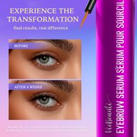 VieBeauti Lash Serum for Eyelash Growth: Eyelash Growth Serum with Advanced Formula to Boost Longer Fuller and Thicker Looking Lashes - Vegan & Cruelty-Free for Sensitive Eyes 3mL - Image 2