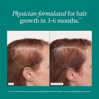 Nutrafol Women's Balance Hair Growth Supplements, Ages 45 and Up, Clinically Proven for Visibly Thicker Hair and Scalp Coverage, Dermatologist Recommended - 1 Month Supply - Image 4