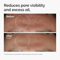 The Ordinary Niacinamide 10% + Zinc 1%, Smoothing Serum for Blemish-Prone Skin - Image 2