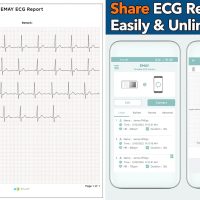 EMAY Portable ECG Monitor | Record ECG and Heart Rate | Compatible with Smartphone and PC - Image 3