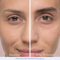 Obagi Nu-Cil Eyebrow Boosting Serum - Ultimate Eyebrow Growth Serum with Hyaluronic Acid - Dermatologist Approved for Thin, Patchy & Over-Tweezed Eyebrows - Fast Absorbing - 6ml - Image 7