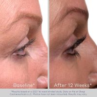 Obagi Nu-Cil Eyelash Enhancing Serum – Nourishing Lash Serum with Biotin for Thicker & More Defined-Looking Lashes - Image 6