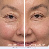 Obagi Nu-Cil Eyebrow Boosting Serum - Ultimate Eyebrow Growth Serum with Hyaluronic Acid - Dermatologist Approved for Thin, Patchy & Over-Tweezed Eyebrows - Fast Absorbing - 6ml - Image 6