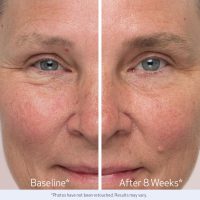 Obagi Nu-Cil Eyebrow Boosting Serum - Ultimate Eyebrow Growth Serum with Hyaluronic Acid - Dermatologist Approved for Thin, Patchy & Over-Tweezed Eyebrows - Fast Absorbing - 6ml - Image 8