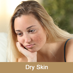 Wood Stove Steamer Fireplace Humidifier