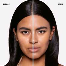Split comparison image showing skin tone and complexion differences between before and after treatment, demonstrating cosmetic results.