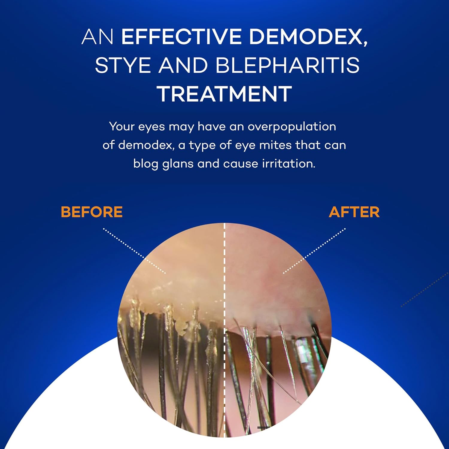 Zocular Zocuwipe Eyelid Wipes with Natural Okra Complex – Gentle Eyelid Cleansing & Moisturizing Pads – 40 Count - Image 9